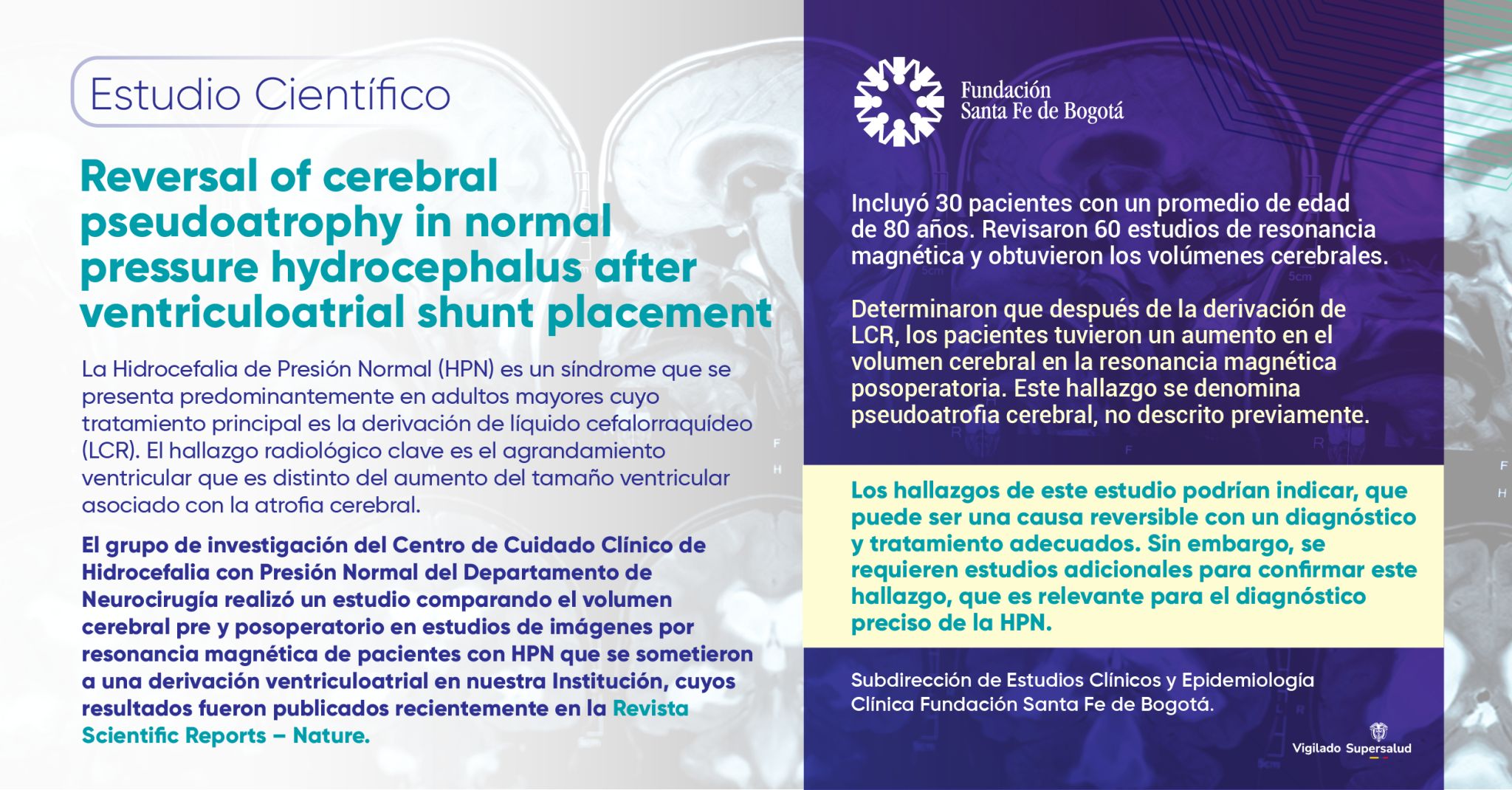 Reversal of cerebral pseudoatrophy