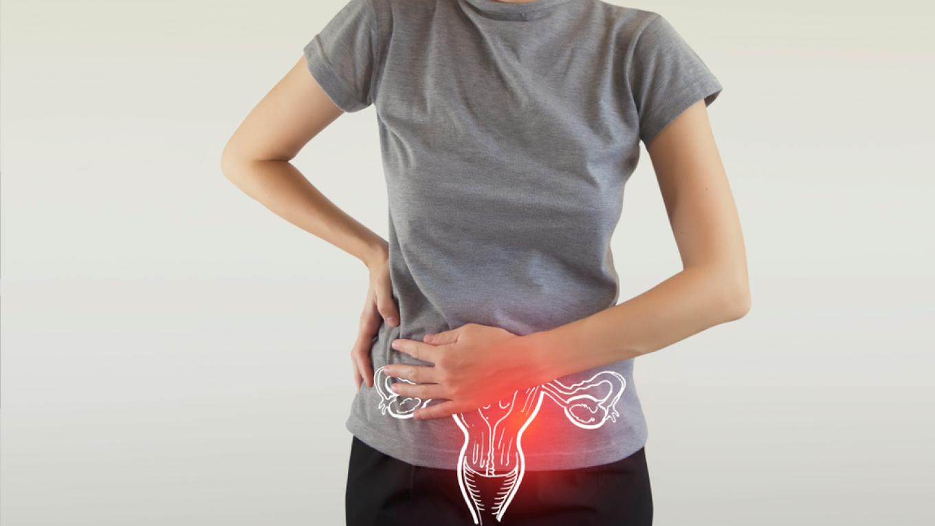 Imagén cáncer de ovario