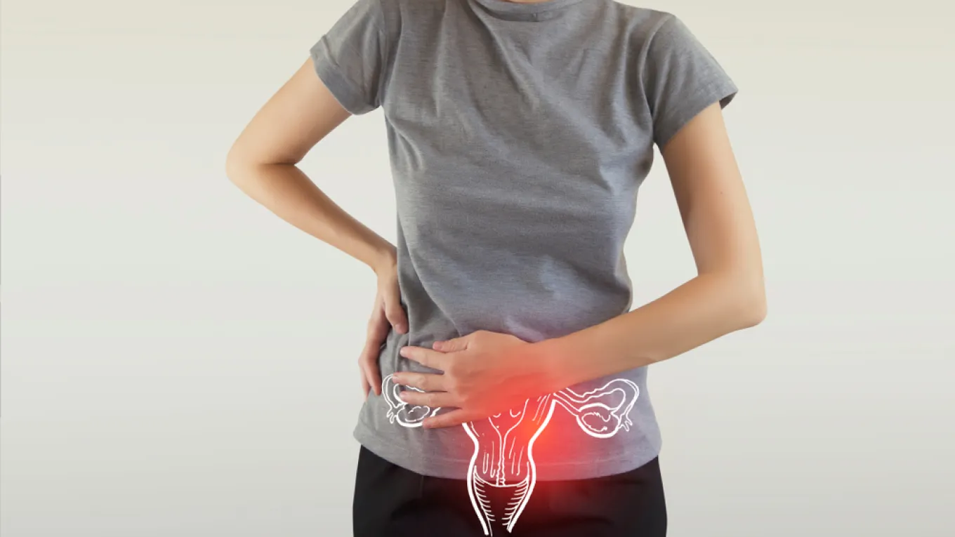 Imagén cáncer de ovario