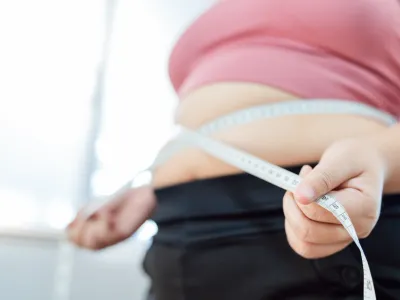 Artículo obesidad - Mercadeo